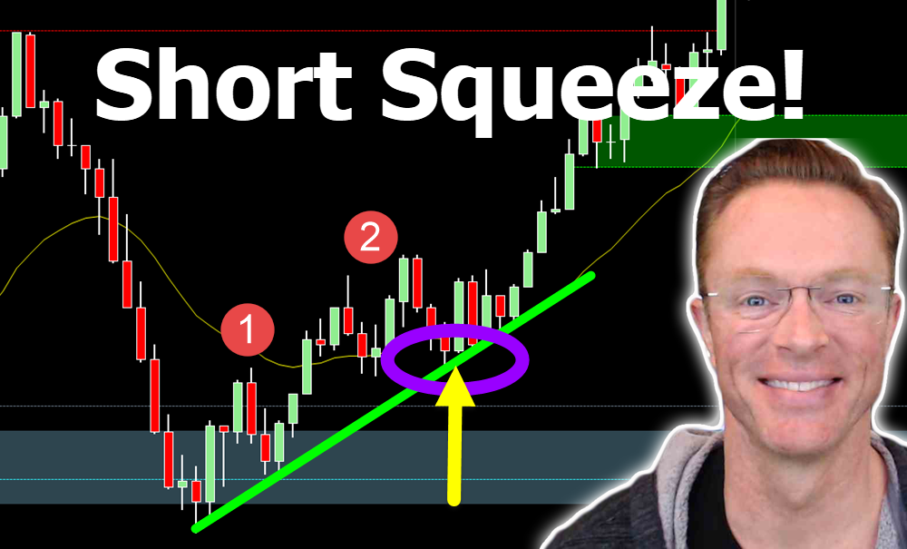 Short squeeze lvl. Scalp Live. Шорт сквиз. Capitalize. Simple forex Strategy.